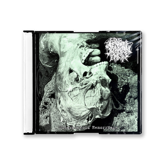 Alkaline Phosphatase "Subarachnoid Hemorrhage" CD