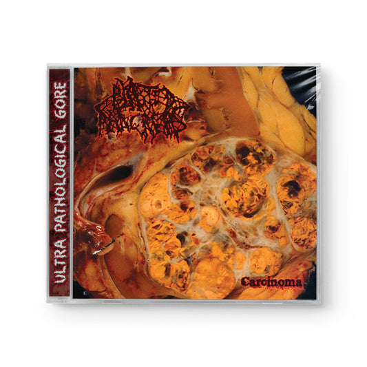 Blasted Pancreas "Carcinoma" CD